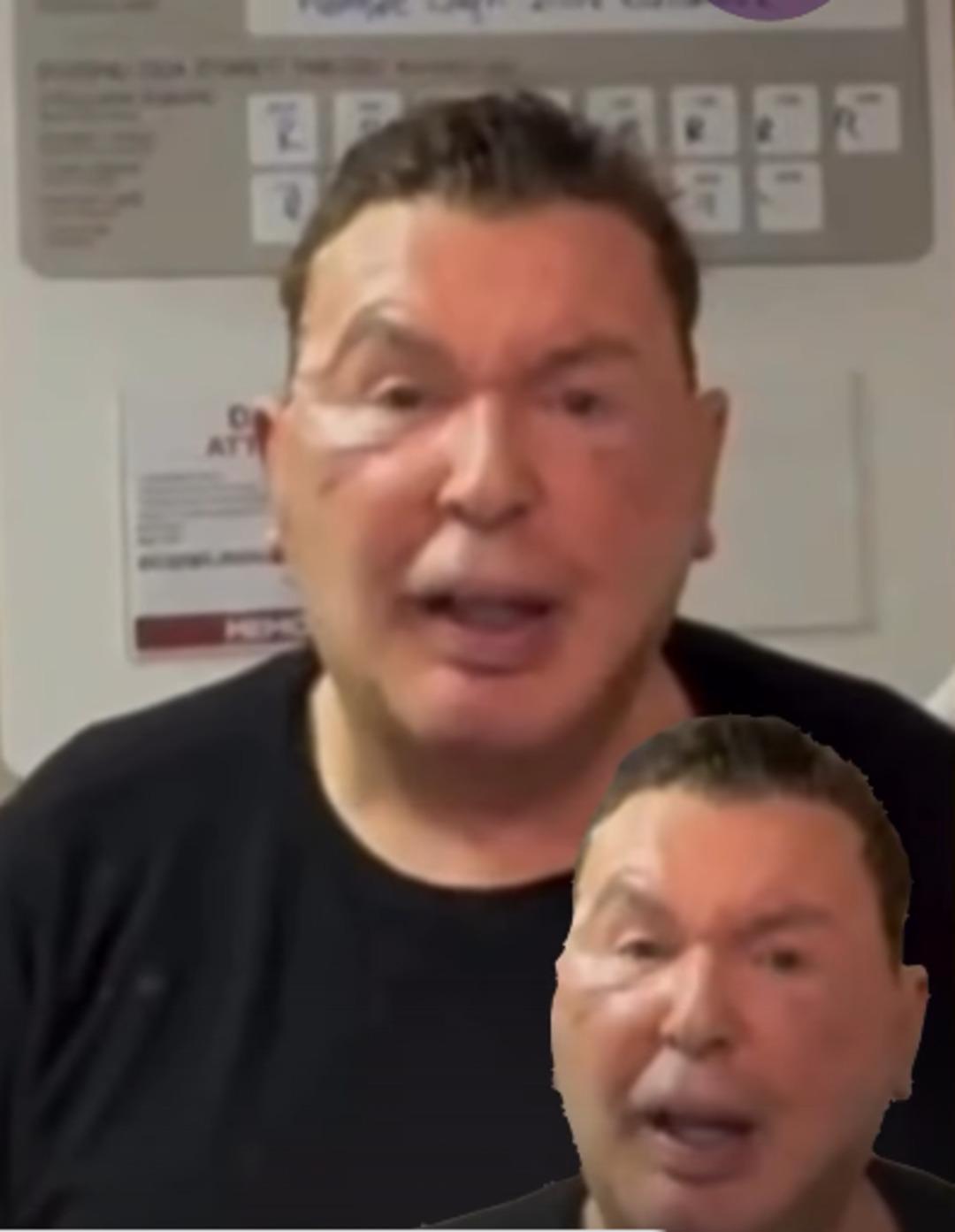 Kuşum Aydın y&uuml;z&uuml;ndeki dolgulardan kurtuldu! İşte son hali 2