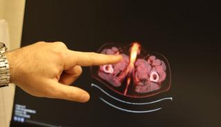 D&uuml;nyada 60 vaka var, sonuncusu Diyarbakır'dan!