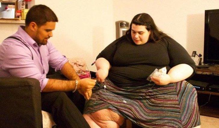 Obezite hastası 200 kilo verdi ilham kaynağı oldu! G3