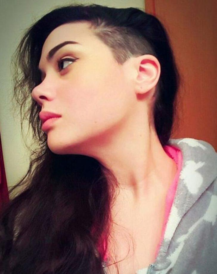 Obezite hastası 200 kilo verdi ilham kaynağı oldu! G4