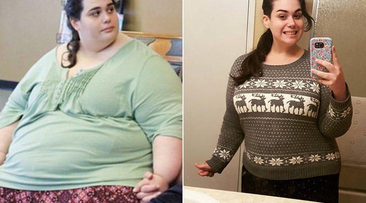 Obezite hastası 200 kilo verdi ilham kaynağı oldu! G5