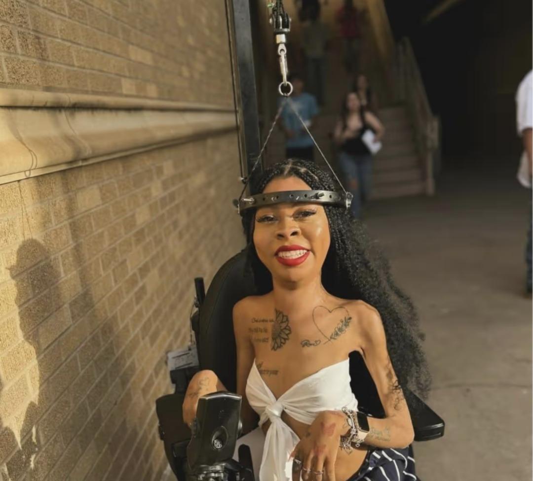 Kafasında 15 vidayla yaşıyor! Sosyal medyada paylaşıp... 4