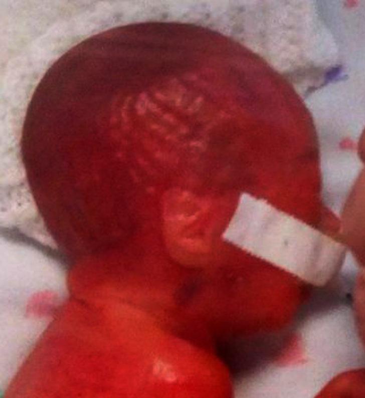 ''Kırmızı bir uzaylıya benziyordu''  G1