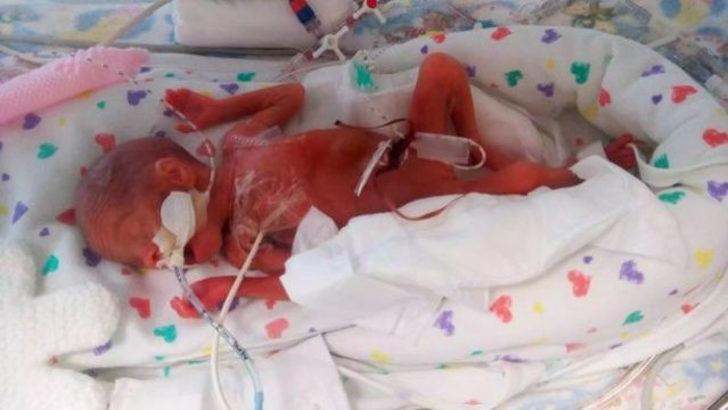 ''Kırmızı bir uzaylıya benziyordu''  G2