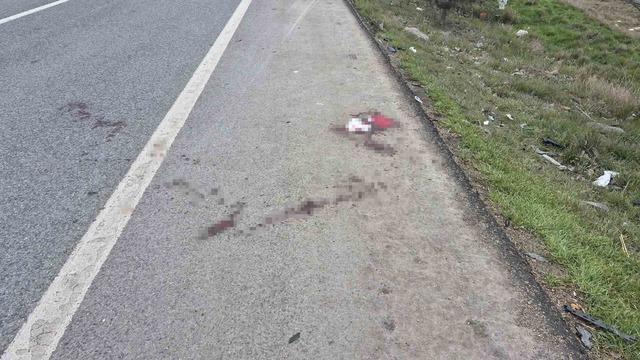 Çevre yolunda otomobilin çarptığı yaşlı adam hayatını kaybetti 4