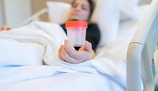 Bu besinleri t&uuml;ketirken dikkat! B&ouml;brek taşına neden oluyor