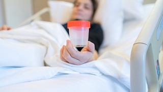 Kadınlarda böbrek taşı görülme oranı arttı! Bu besinleri tüketirken dikkatli olun