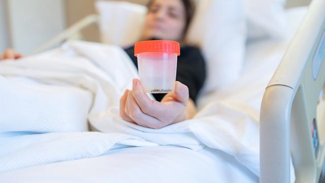 Kadınlarda böbrek taşı görülme oranı arttı! Bu besinleri tüketirken dikkatli olun