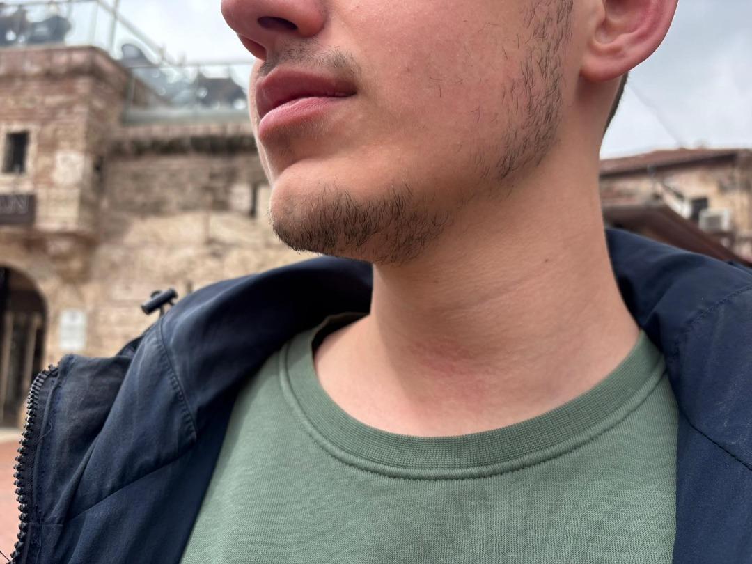 Kuyumcuda akılalmaz olay: Altın kuyruğunu görüntüleyen muhabiri darbettiler! 1