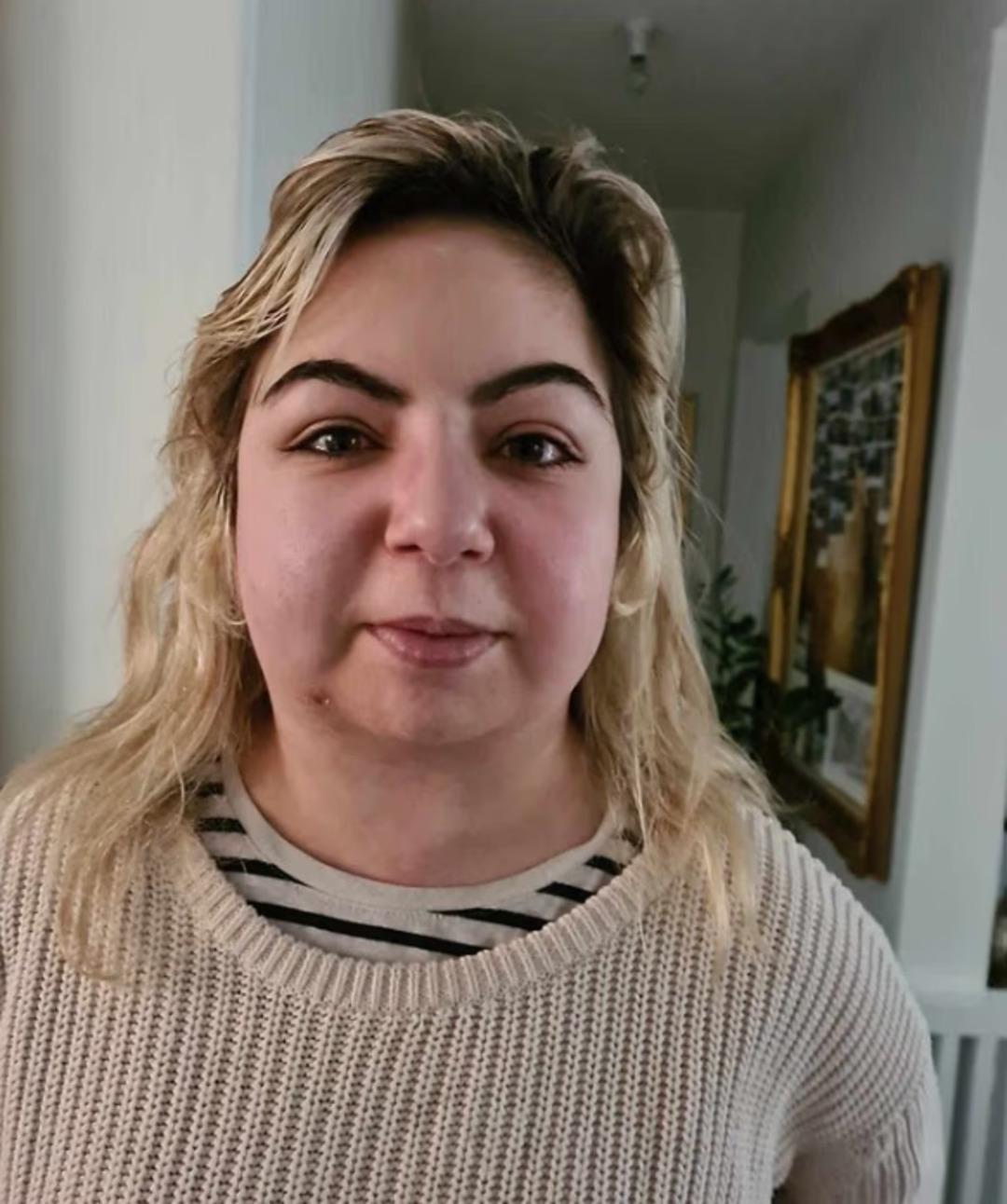 Aylarca yanlış teşhis konuldu: Hastalığı bambaşka çıktı! Ölümün eşiğinden döndü 1