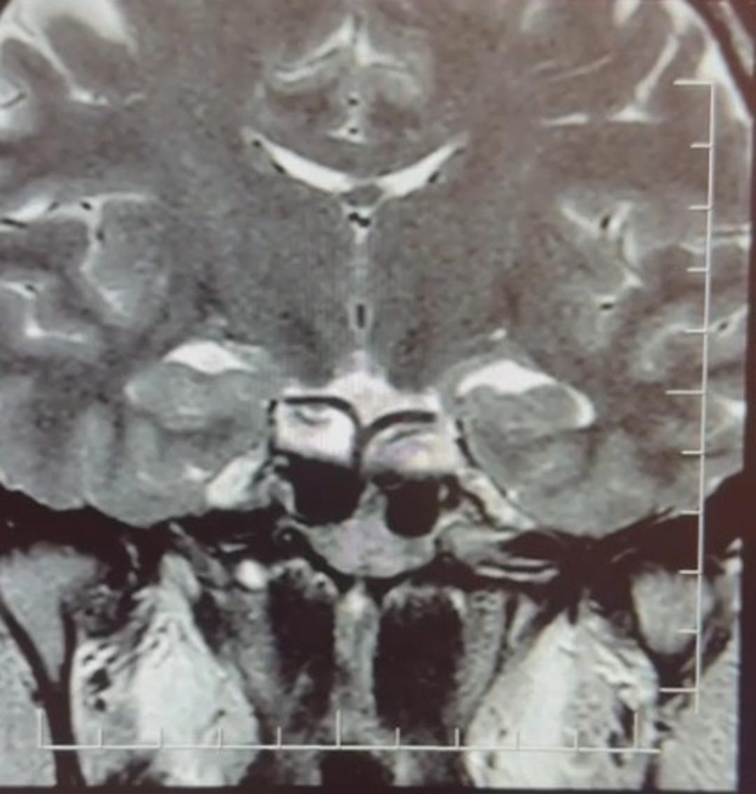  Hamileyim  diye geldi, gebelik belirtileri başka bir hastalığın habercisi &ccedil;ıktı 1