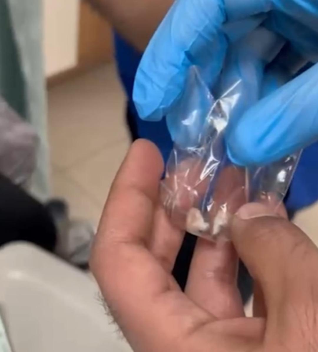 Yer: Kayseri... Uyuşturucuyu sakladığı yer ekipleri bile şaşkına &ccedil;evirdi! 5