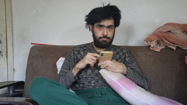 3 yıl sonra duş alıp, tıraş olmuştu! Telefon bağımlısı gencin son hali ortaya çıktı