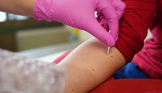 Milyonlarca kişi i&ccedil;in kabus başladı! Polen alerjisi alarmı