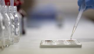 Yanlışlıkla i&ccedil;ilen kimyasallar yemek borusunda delinmeye neden oluyor