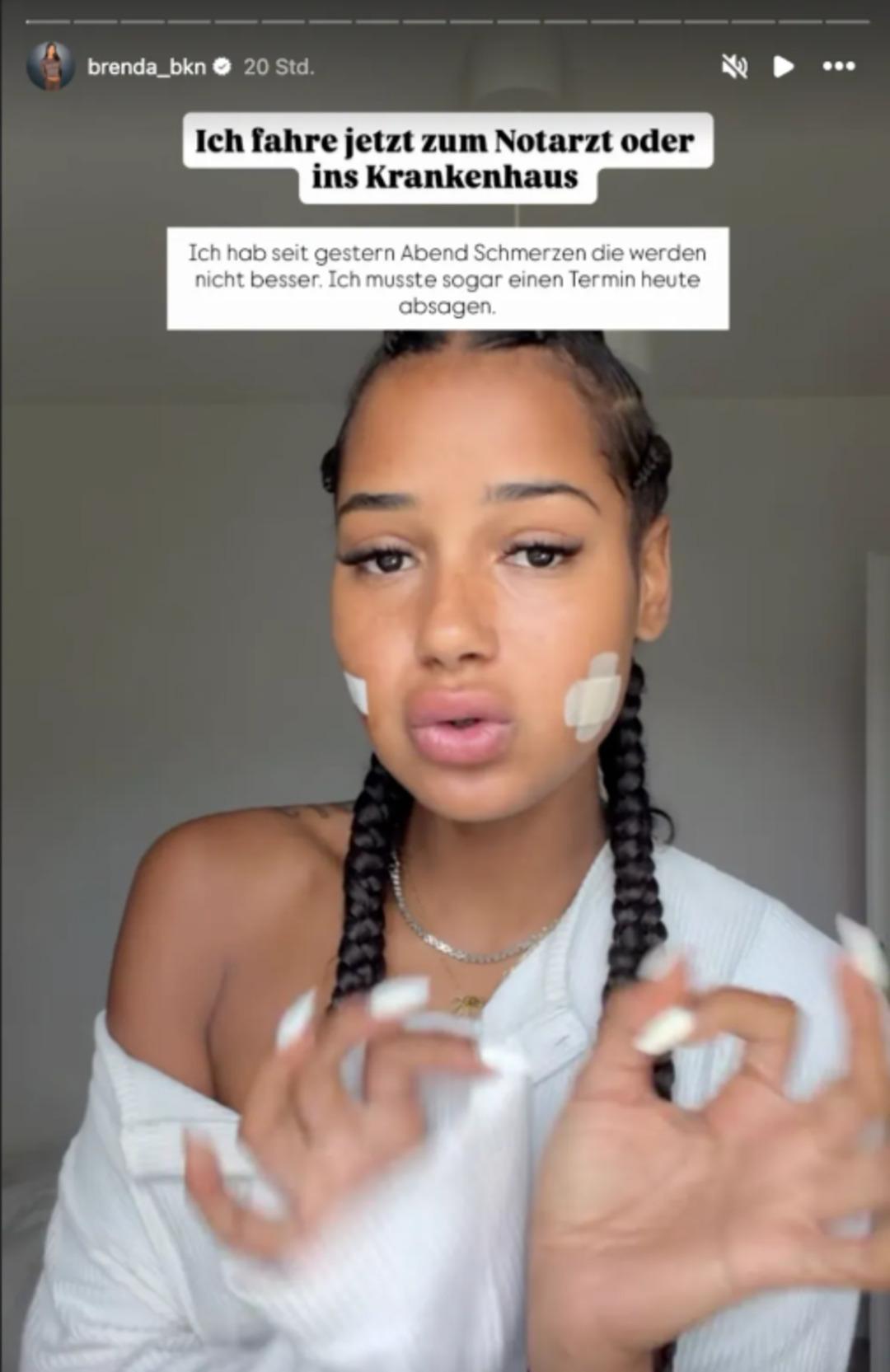 Yaptırdığı estetik sonrası t&uuml;m y&uuml;z&uuml; iltihaplandı! &Uuml;nl&uuml; fenomenin son hali 1