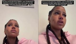 Yaptırdığı estetik sonrası t&uuml;m y&uuml;z&uuml; iltihaplandı!