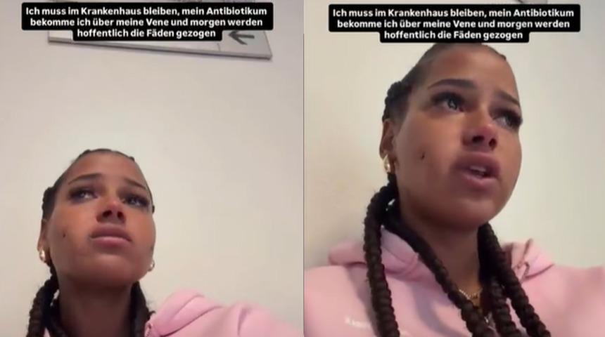 Yaptırdığı estetik sonrası t&uuml;m y&uuml;z&uuml; iltihaplandı! &Uuml;nl&uuml; fenomenin son hali