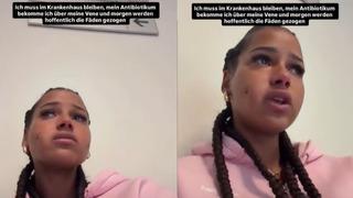 Yaptırdığı estetik sonrası tüm yüzü iltihaplandı! Ünlü fenomenin son hali