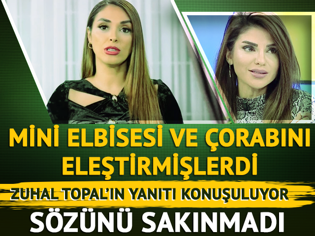 Mini elbisesini eleştirdi! Zuhal Topal s&ouml;z&uuml;n&uuml; sakınmadı