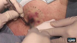 İçinden çıkan şoke etti 