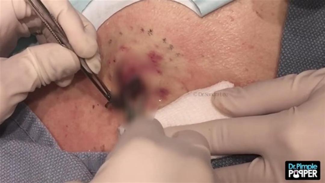 İ&ccedil;inden &ccedil;ıkan şoke etti 