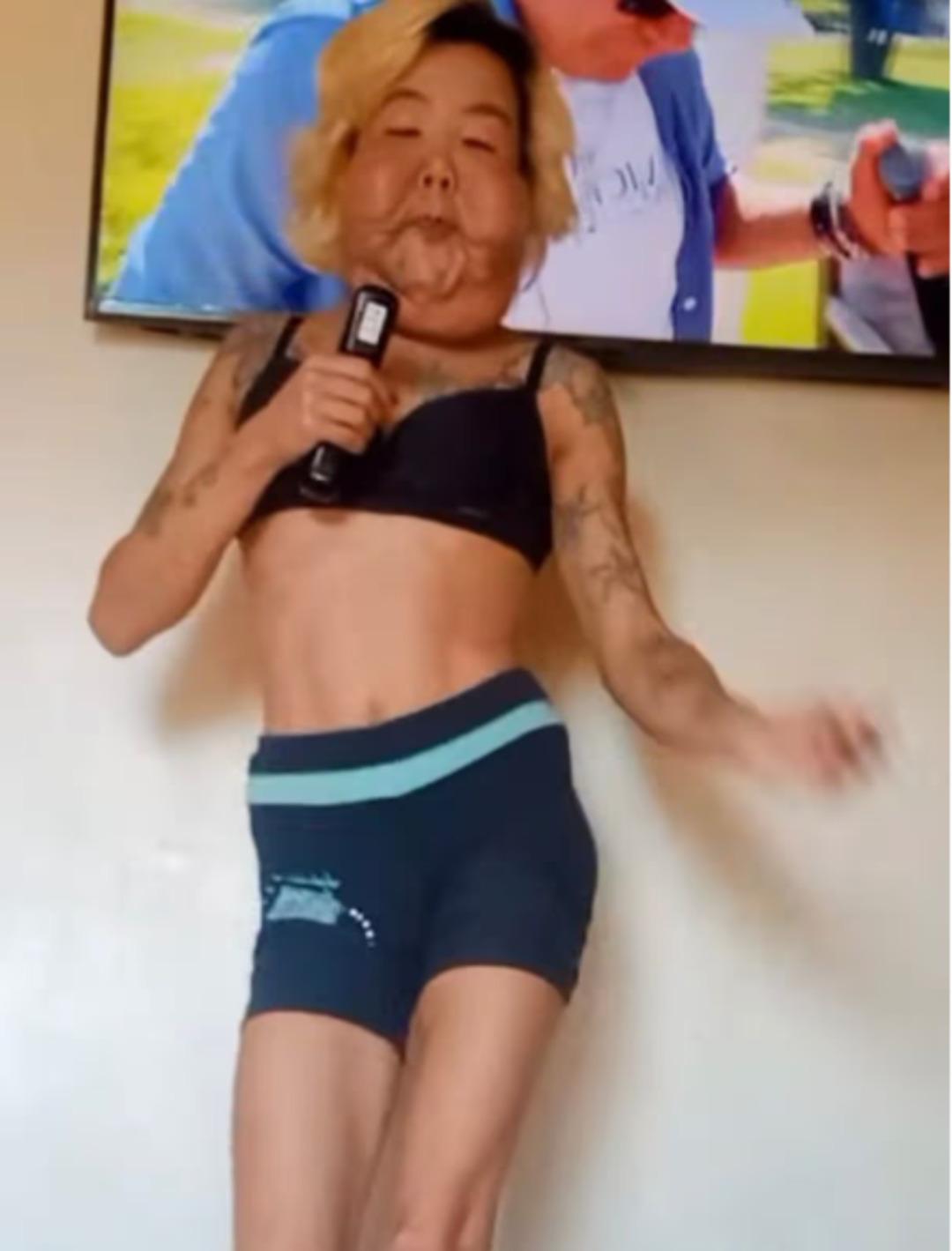 Estetikten yüzü şişip erimişti! Şimdi de göğüslerini yaptırdı 3