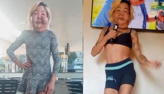 Estetikten y&uuml;z&uuml; şişip erimişti! Şimdi de g&ouml;ğ&uuml;slerini yaptırdı