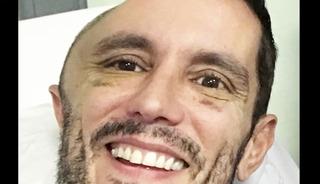 Metroda d&uuml;şt&uuml;, uyandığında kafatasının yarısı yoktu!