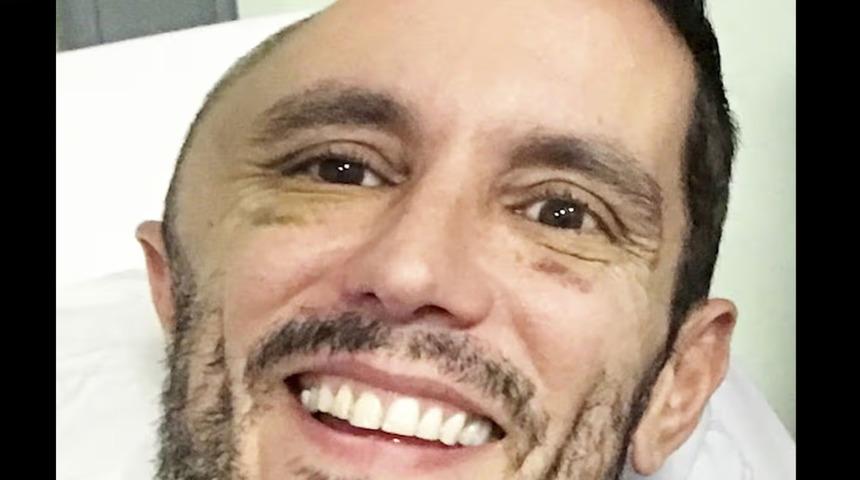 Metroda d&uuml;şt&uuml;, uyandığında kafatasının yarısı yoktu! "Dokunduğumda beynimi hissedebiliyordum&rdquo;