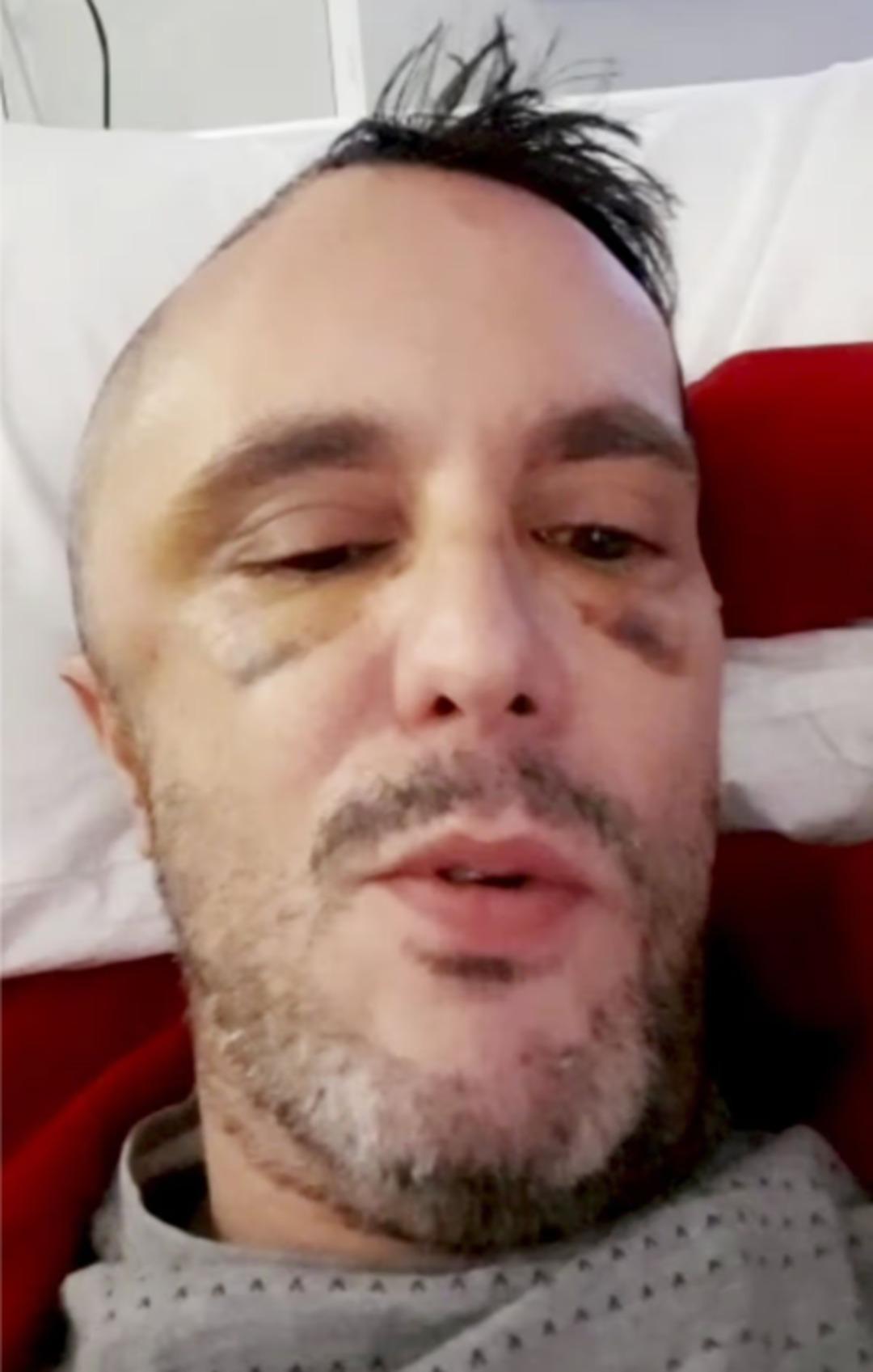 Metroda d&uuml;şt&uuml;, uyandığında kafatasının yarısı yoktu! "Dokunduğumda beynimi hissedebiliyordum&rdquo; 1