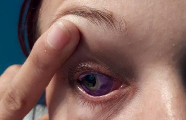 Biyokinezi Goz Rengi Degistirme Gercek Mi Biyokinezi Goz Rengi Degistirme Gercek Mi
