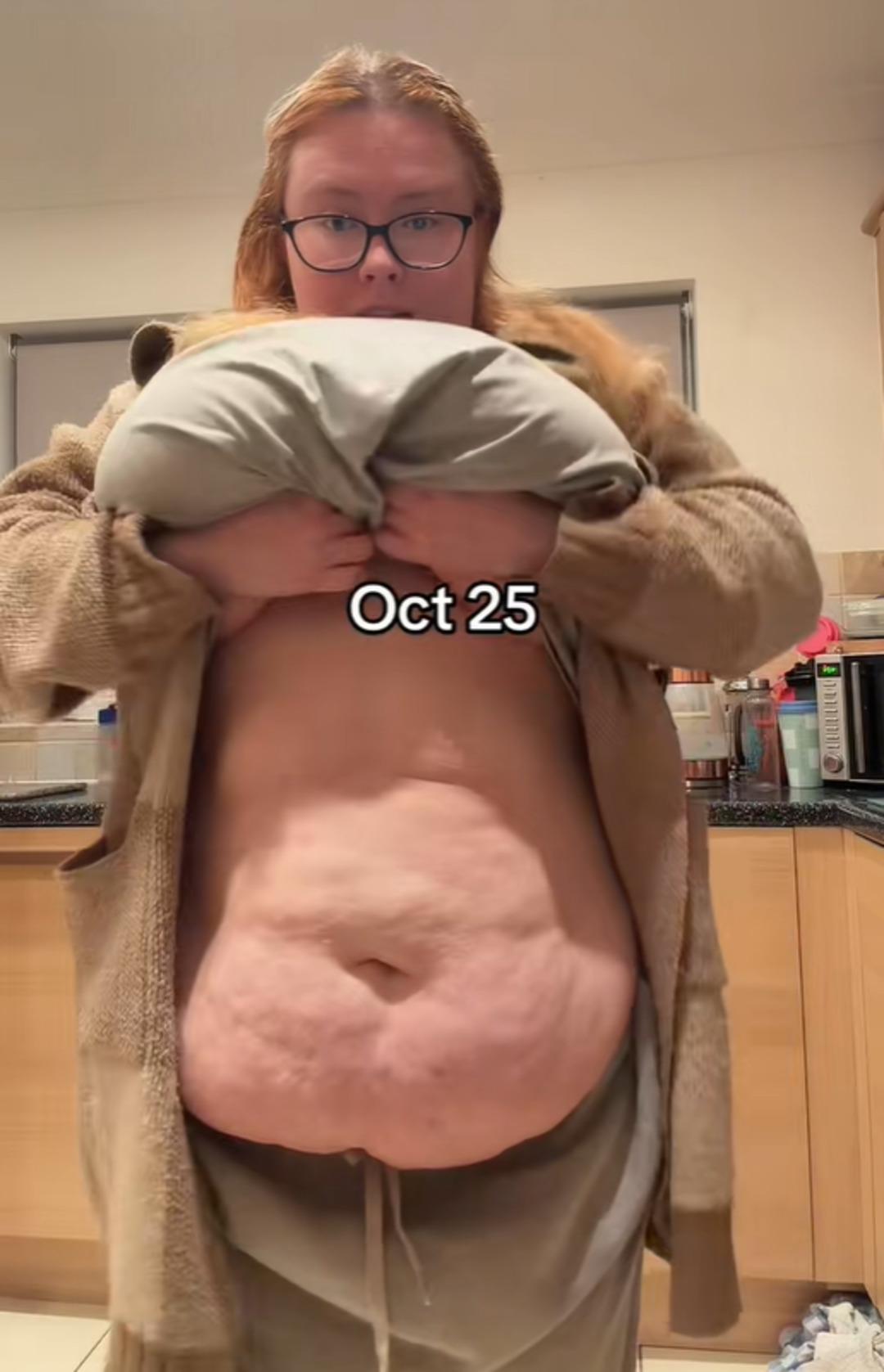 G&ouml;ğ&uuml;sleri  yapay zeka  sanıldı: Sosyal medya hesapları kapatıldı! 3