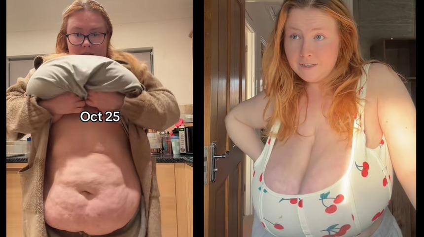 G&ouml;ğ&uuml;sleri 'yapay zeka' sanıldı: Sosyal medya hesapları kapatıldı!