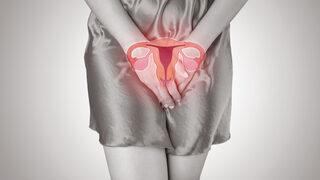 Çikolata kisti ile nasıl baş edebiliriz?