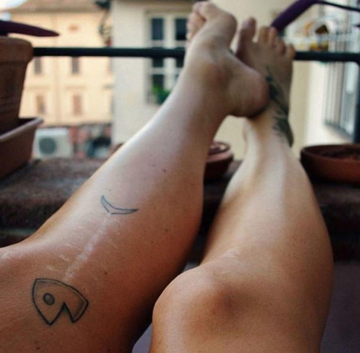 Yara izlerinin sanatın bir parçası olamayacağını kim söyledi?