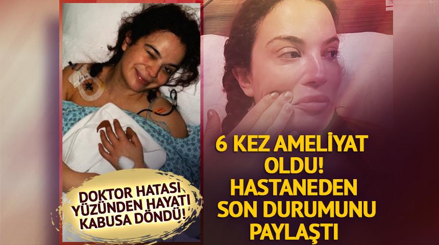 Doktor hatası y&uuml;z&uuml;nden hayatı kabusa d&ouml;nd&uuml;! Son halini paylaştı