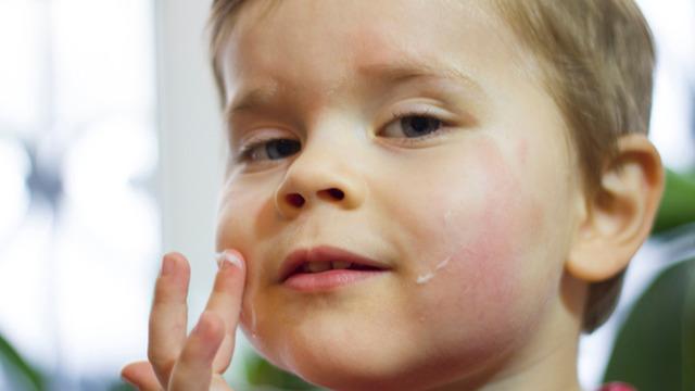 Egzaması olan bebekler için altın değerinde tavsiyeler 