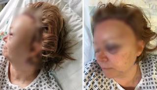 Yıllarca fark edilmedi: Bir anda fenalaştı!