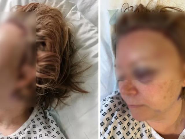 Yıllarca fark edilmedi: Bir anda fenalaştı!