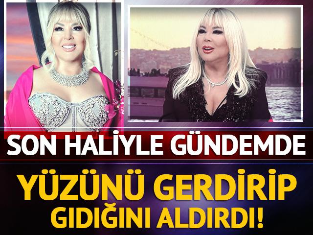 Y&uuml;z&uuml;n&uuml; gerdirip gıdığını aldırdı! Son haliyle g&uuml;ndemde