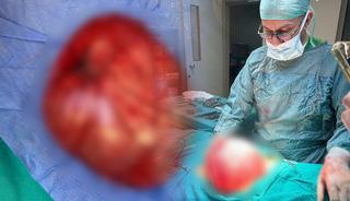 Kilo vermek isteyen &ccedil;ocuğun karnından &ccedil;ıktı!