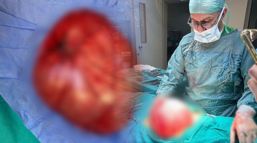 Kilo vermek istemişti: 14 yaşındaki &ccedil;ocuğun karnından &ccedil;ıktı!