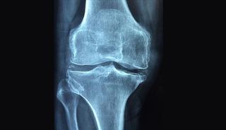 Dikkat! Sessiz ilerliyor: "&Ouml;l&uuml;me kadar g&ouml;t&uuml;rebilir"