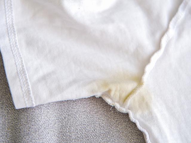 &Ccedil;amaşır suyu tarihe karışıyor! Sararan &ccedil;amaşırlara limon desteği!