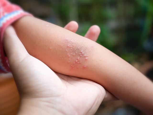 Cam bardak testiyle anlaşılabiliyor! Menenjitte hayati uyarı