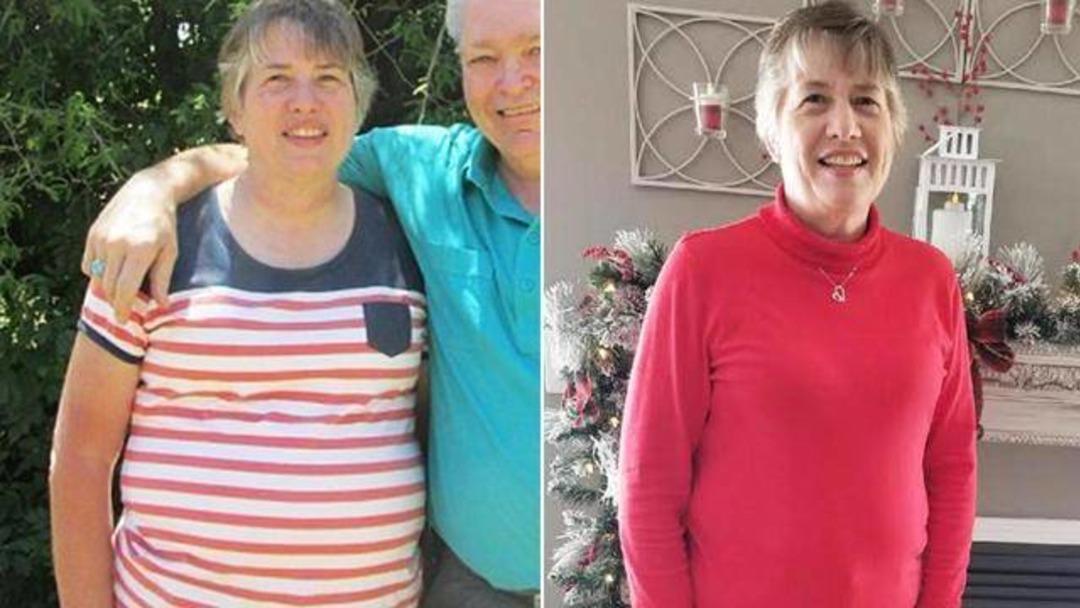 Kilo aldığını sandı, v&uuml;cudundan 20 kiloluk dev t&uuml;m&ouml;r &ccedil;ıktı!