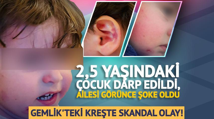 Gemlik&rsquo;te &ouml;zel kreşte skandal: 2,5 yaşındaki &ccedil;ocuk darp edildi