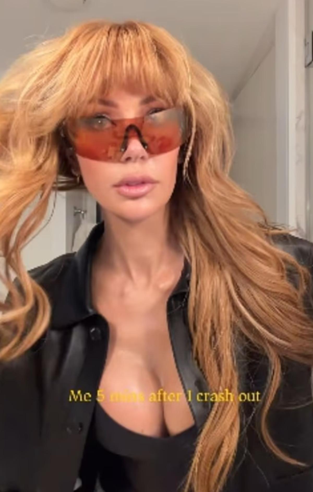 Olivia Attwood dan g&ouml;ğ&uuml;s estetiği itirafı: Sanki biri beni şişirmiş gibiydi 2