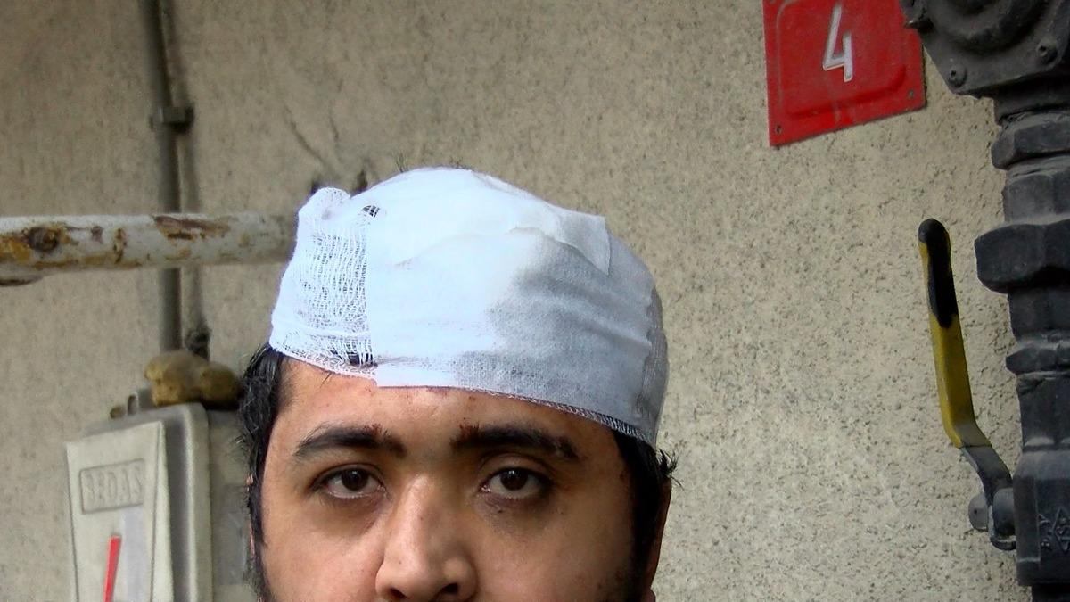 Sultangazi de zihinsel engelli ve annesine sopalı saldırı!  Beni istemiyorlar  2